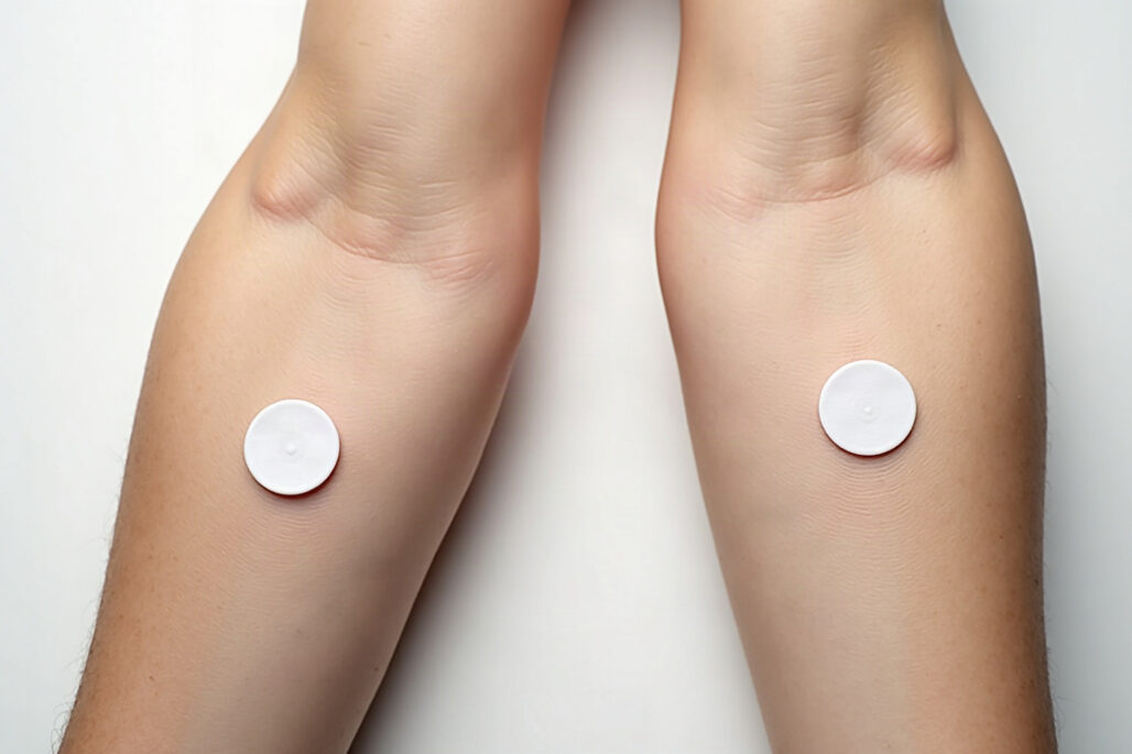 Two arms side by side, each wearing a round glucose biosensor